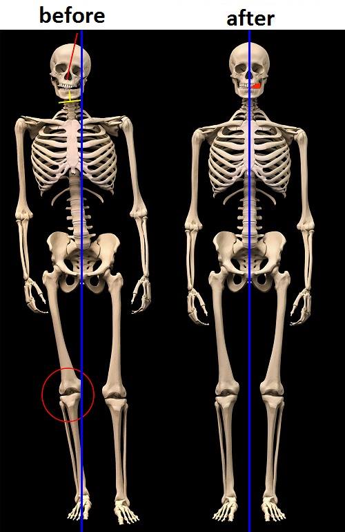 compared skeleton