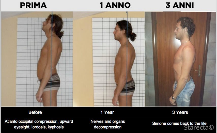 evolution starecta posture