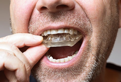 bite tetemporomandibular
