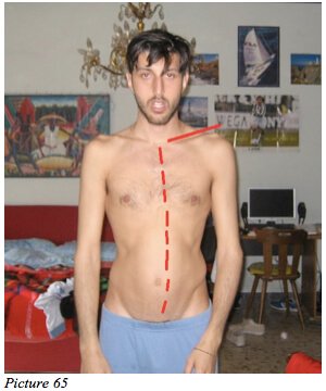 moreno starecta