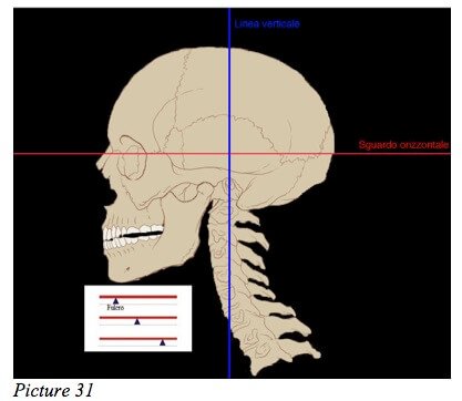 skull starecta